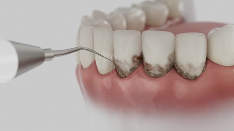 Trusted Wisdom Tooth Removal service in McLouth, KS - Dentist Open Now